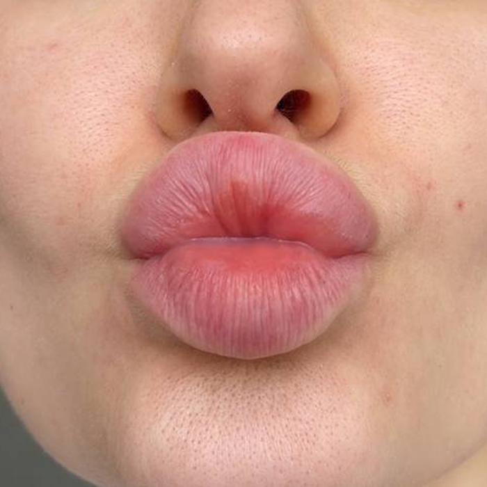 Після: Гладенькі та зволожені